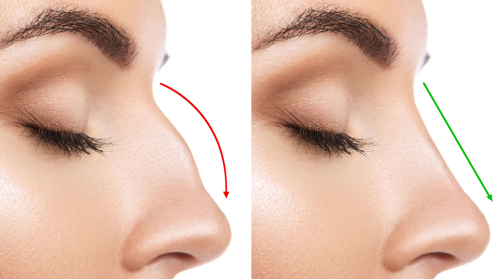 leitourgiki_rinoplastiki