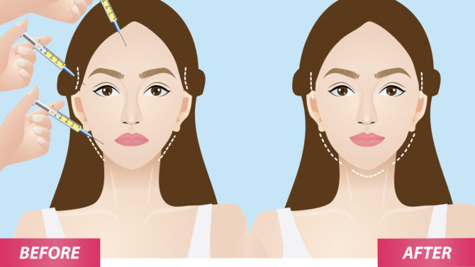 lipolifting-hero image