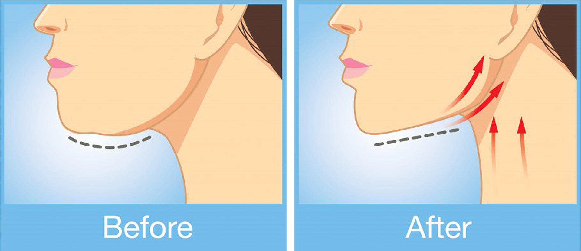 pogonoplastiki-hero image